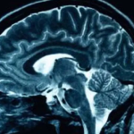 The Brain’s Great Bridge