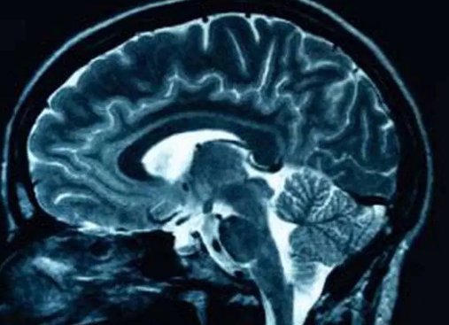 The Brain’s Great Bridge